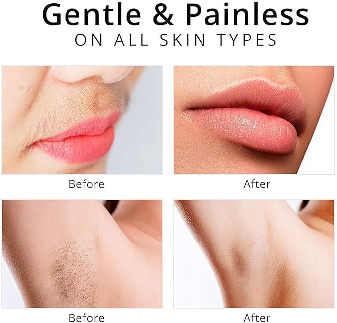 Electric Facial Hair Remover — Painless, Portable & Rechargeable