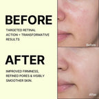 Celimax Vita A Retinal Cream 15mL — Buy 1 Get 1 FREE | Anti-Ageing + Skin Tightening