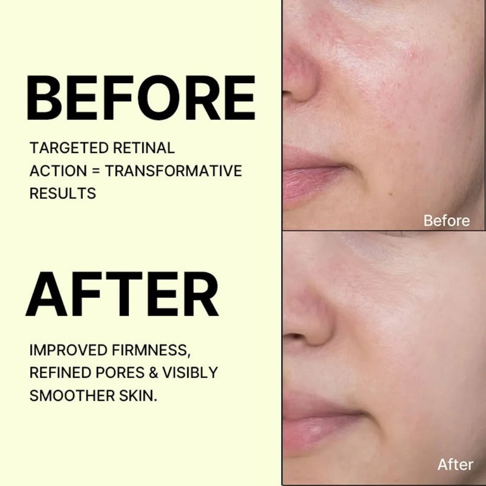 Celimax Vita A Retinal Cream 15mL — Buy 1 Get 1 FREE | Anti-Ageing + Skin Tightening
