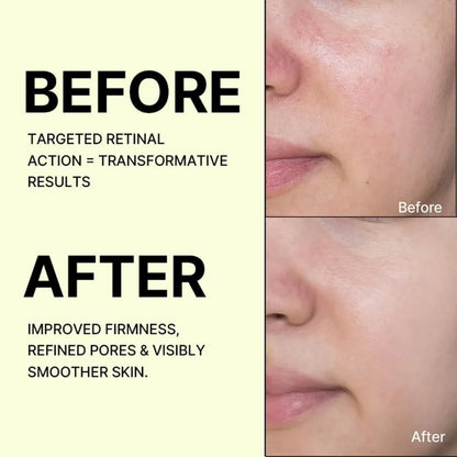 Celimax Vita A Retinal Cream 15mL — Buy 1 Get 1 FREE | Anti-Ageing + Skin Tightening