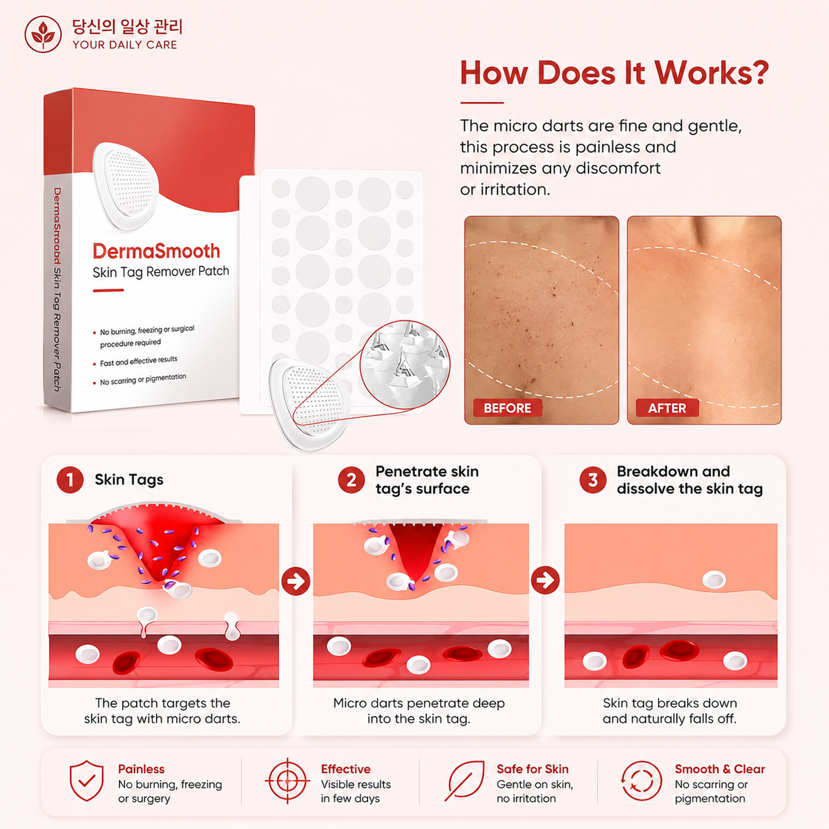 DermaSmooth Skin Tag Remover Patch 144 Patchs