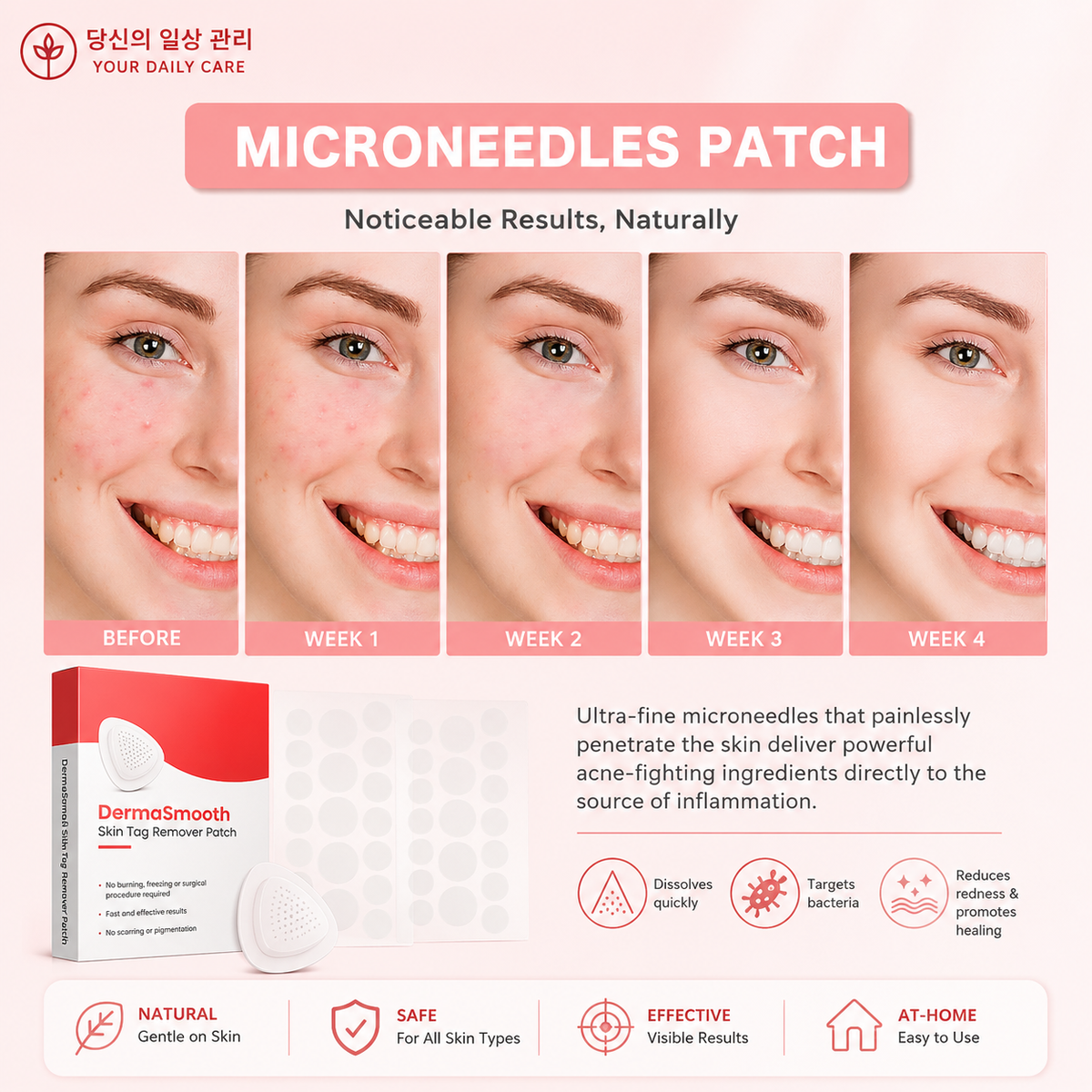 DermaSmooth Skin Tag Remover Patch 144 Patchs