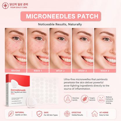DermaSmooth Skin Tag Remover Patch 144 Patchs