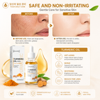 Pure Turmeric Essential Oil for Face Serum– Hydrating |Whitening Skin | Natural Glow | Dark Spot Removal| BUY 1 GET 1 FREE (BOGO)